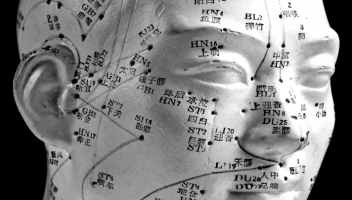 Acupuncture